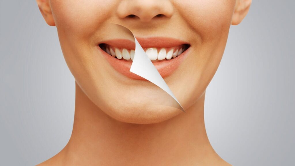 Cosmetic Dentist Melbourne: Transforming Smiles and Boosting Confidence