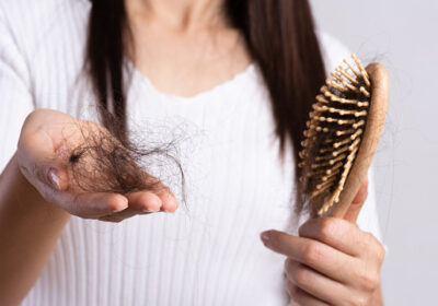 What Causes Hair Loss in Teenagers, and How to Treat It?