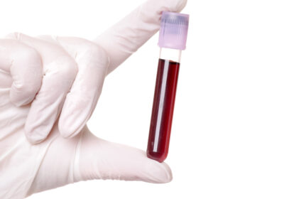Biochemical and Metabolic Profiles in Basic Blood Investigations: A Primer for Healthcare Professionals