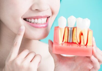Unsure About Dental Implants? Addressing Common Concerns in Edinburgh