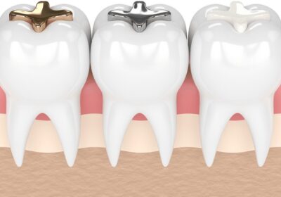 Understanding the Different Types of Dental Procedures