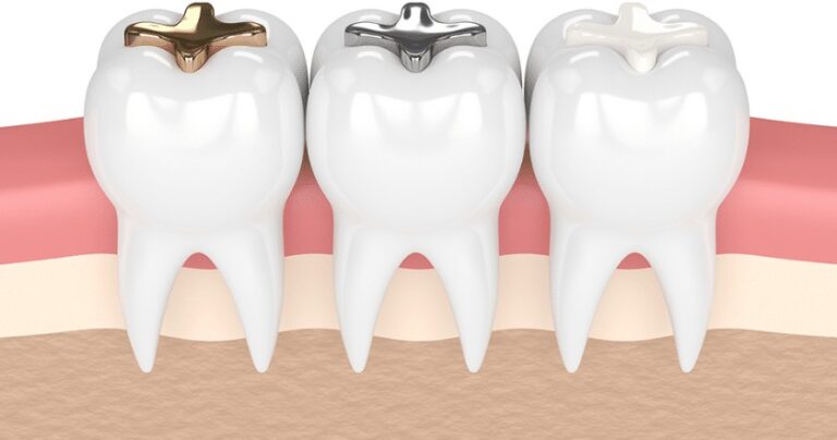 Understanding the Different Types of Dental Procedures