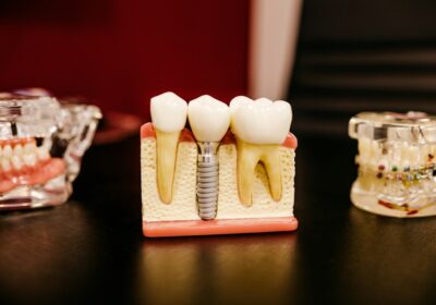 Why Dr. Saloni Angra is Your Best Choice for Dental Care in Hopewell Township, NJ