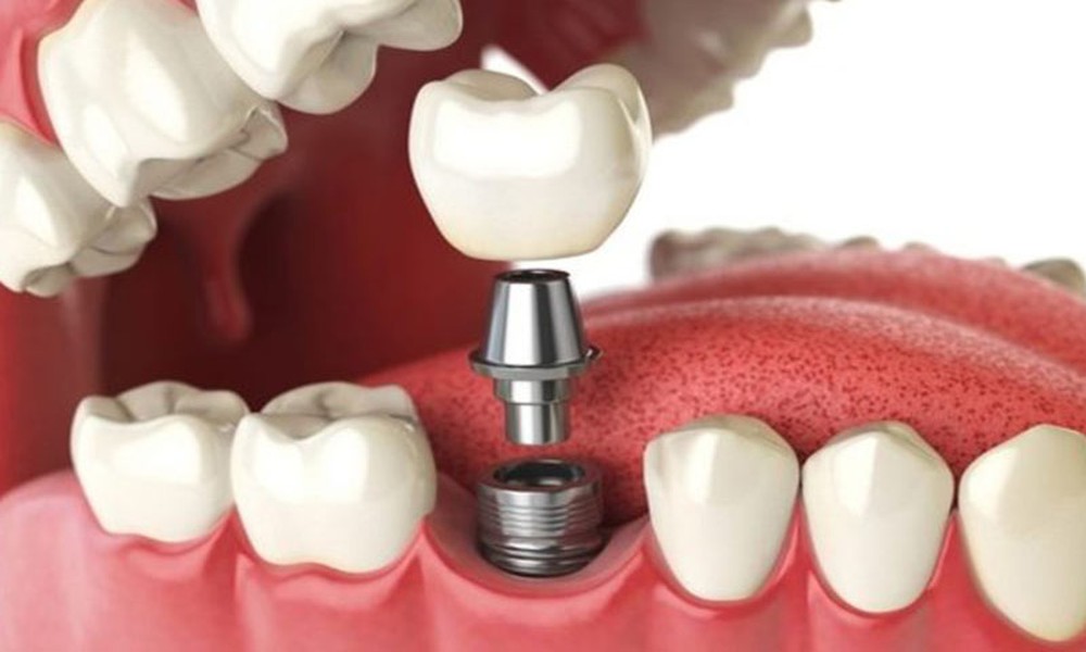 article_3891_featured