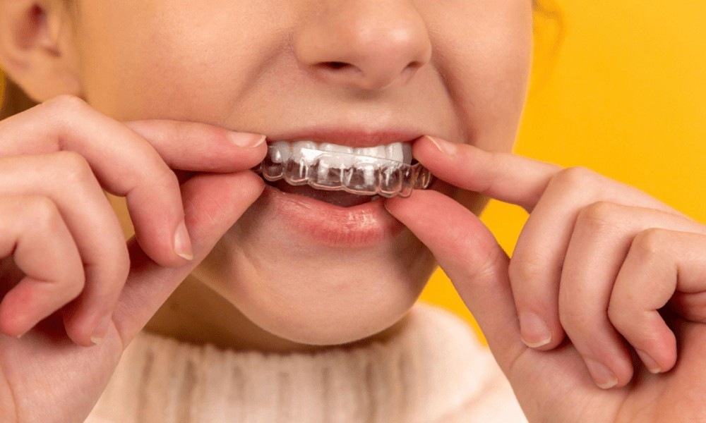 patient_compliance_metrics_how_orthodontists_measu_21623_featured