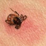 article_32485009_featured_1775458185